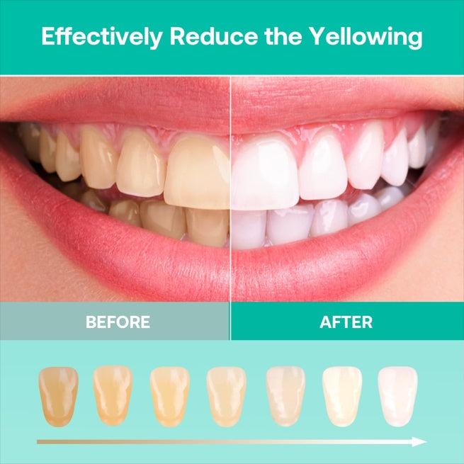 teeth whitening device